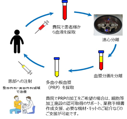 PRP（多血小板血漿）治療の流れ